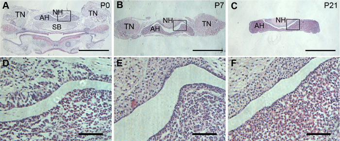 Histology section diagram comparing developmental stages; anatomical features labeled (TN, NH, AH).