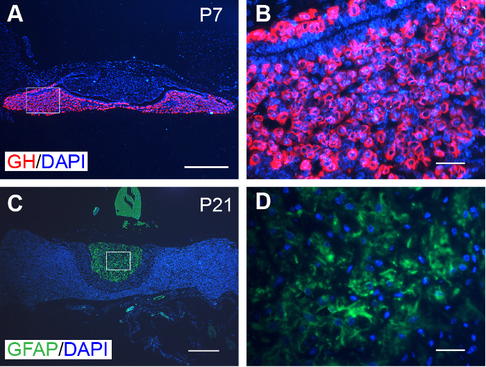 Immunofluorescence of GH/DAPI and GFAP/DAPI in brain sections; microscopy image.