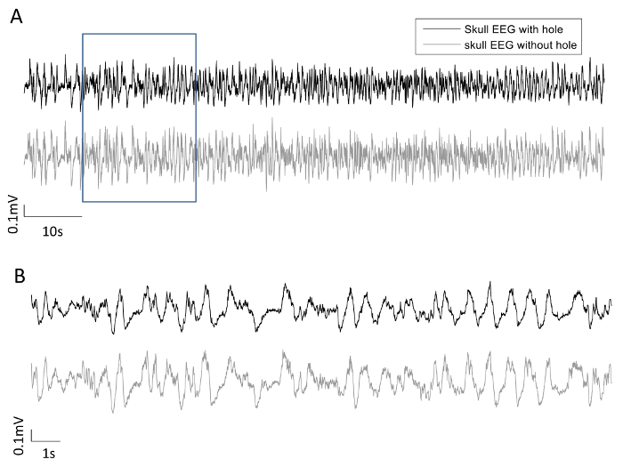 figure-results-3 EEG analysis comparing skull with hole vs. without hole; brain activity graph with voltage scale.