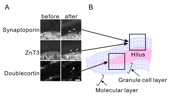 Synaptoporin, ZnT3, Doublecortin analysis; diagram shows hippocampal neuron changes before/after.
