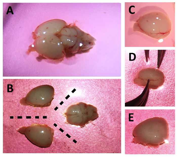 Dissection of fly larval brain; diagrams showing tissue separation steps and tweezers for microdissection.