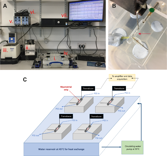 figure-results-2 Myometrial study setup: transducer system, heat exchange at 45°C, myometrial data acquisition diagram.