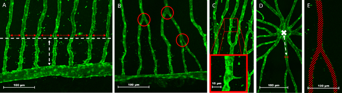 figure-discussion-1 Confocal microscopy images showing zebrafish vascular development pattern analysis.