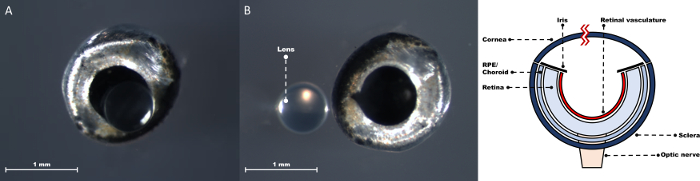 figure-protocol-4 Eye anatomy diagram with lens, cornea, retina; microscopic eye structure with lens separation.