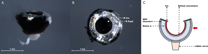 figure-protocol-6 Retinal structure microscopy and diagram; iris, pupil labeled; cross-sectional anatomy illustration.