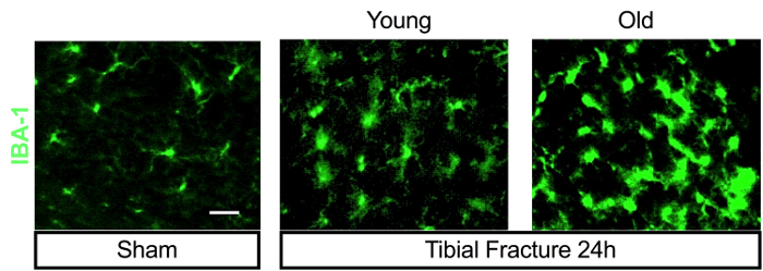 figure-results-3 Immunofluorescence images showing IBA-1 marking in sham, young, and old tibial fracture.
