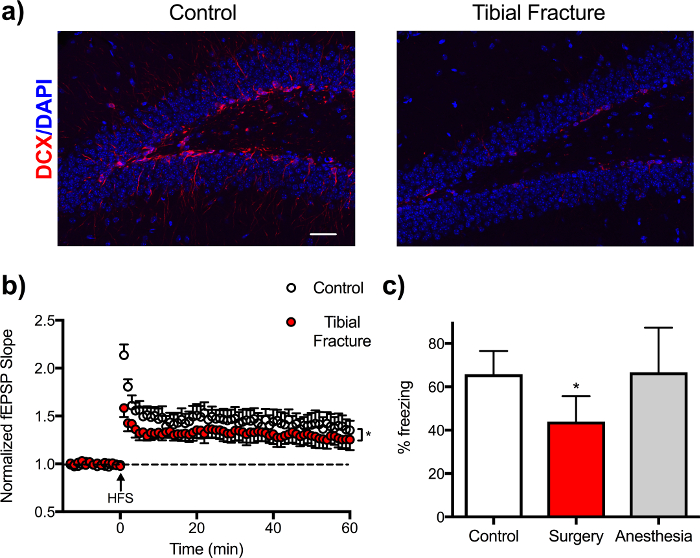 figure-results-4 Tibial fracture effect on neuron density (DCX/DAPI), synaptic slope, and freezing response in mice.