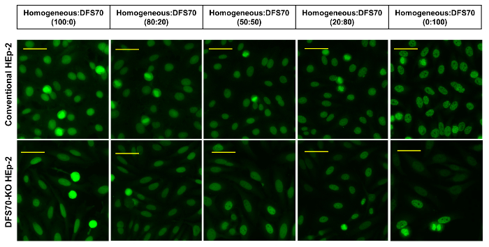figure-results-3 Fluorescence microscopy, cell staining comparison, HEP-2 cells, DFS70 autoantibody detection.