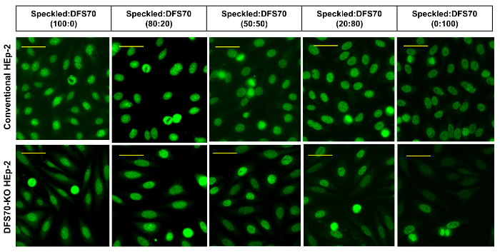 figure-results-4 Hep-2 cells fluorescence microscopy; protein localization; experiment results; cell nuclei; speckled pattern.