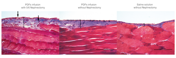 Histological comparison of tissue samples: nephrectomy, PDFs infusion, saline control.