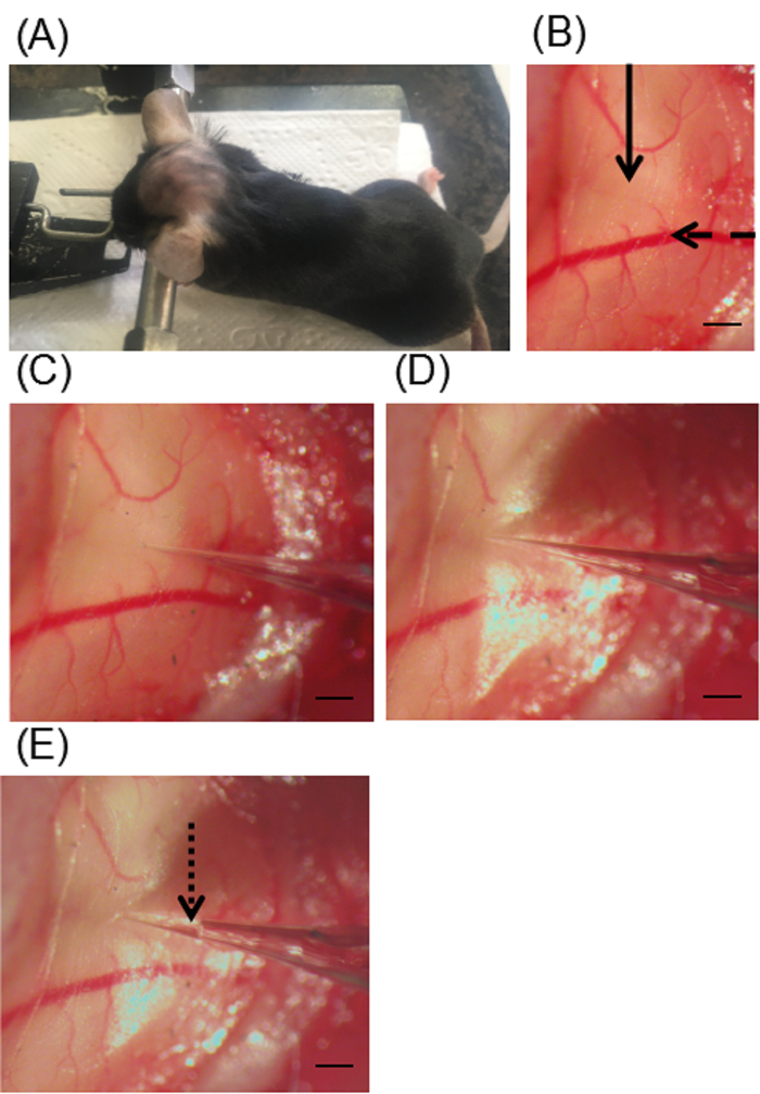 Mouse brain microinjection process showing needle insertion in vascular network. Experimental method.
