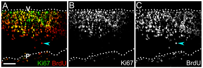 figure-results-4 Ki67 BrdU staining, fluorescence microscopy; diagrams comparing cell proliferation markers in tissue sections.