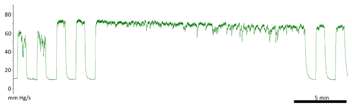 figure-results-13 Blood pressure fluctuation graph, mm Hg/s vs. time, data analysis in cardiovascular study.