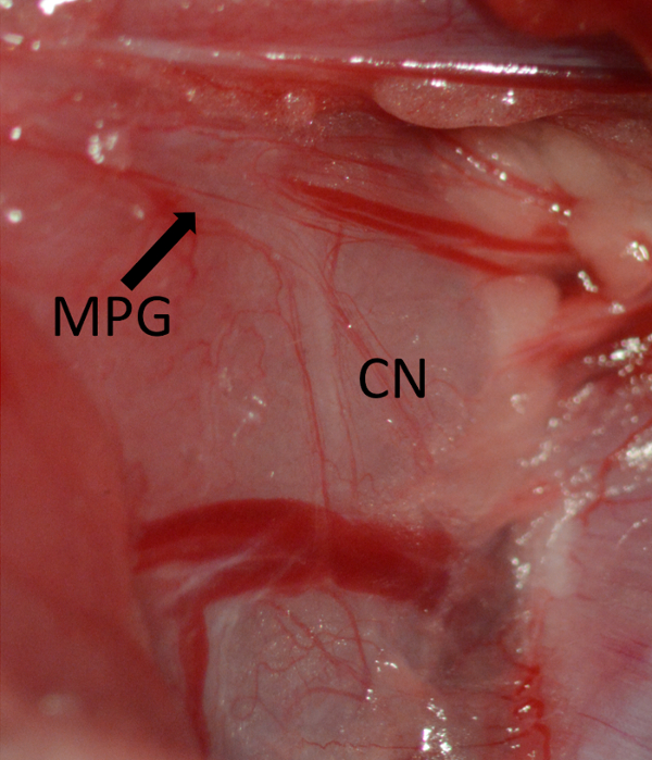 figure-results-5 Anatomy dissection showing MPG and CN in tissue, diagram for neurological study.