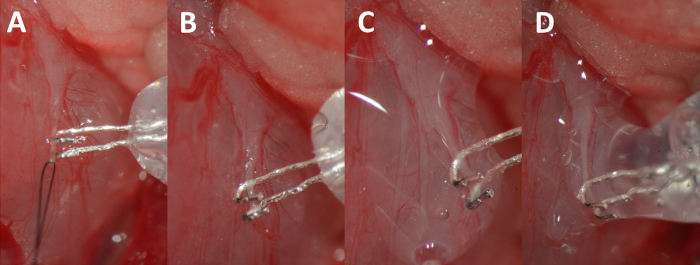 figure-results-7 Surgical suture process in four stages, diagram showing precise needle placement and technique.