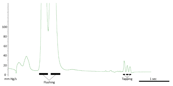 figure-results-9 Blood pressure waveform; flushing and tapping events; pressure (mm Hg/s) vs. time (sec) graph.