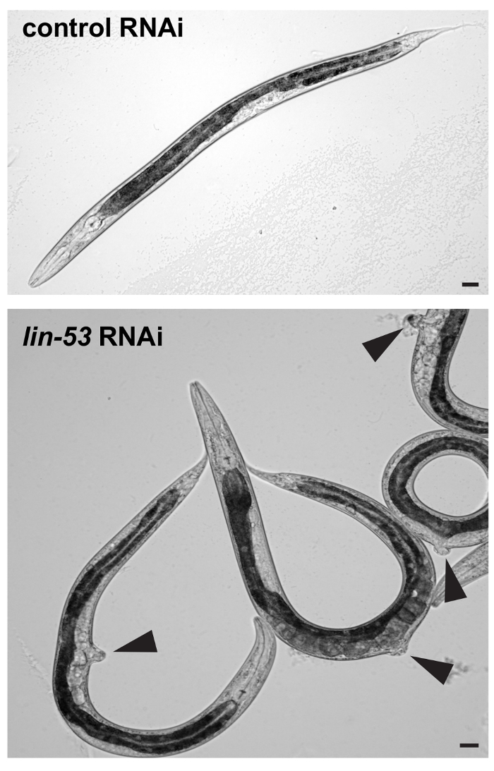 RNAi effect on C. elegans morphology; microscopy comparison between control and lin-53 RNAi treatment.