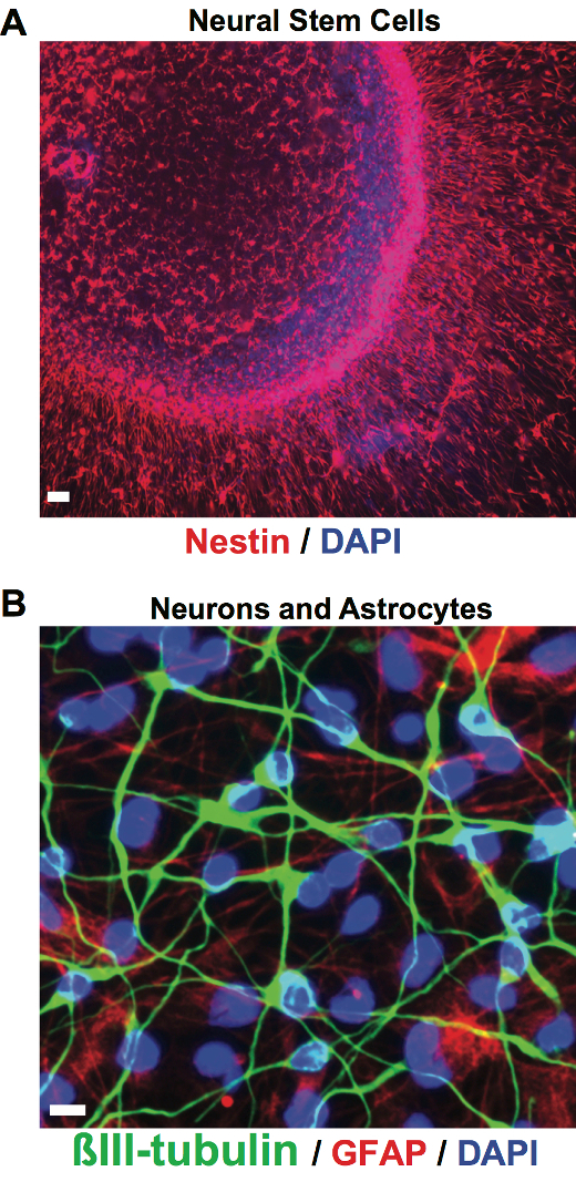 Zika Virus Infection of Cultured Human Fetal Brain Neural Stem Cells ...