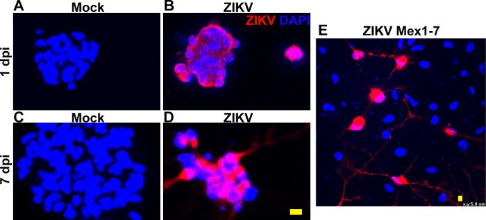 Zika Virus Infection of Cultured Human Fetal Brain Neural Stem Cells ...