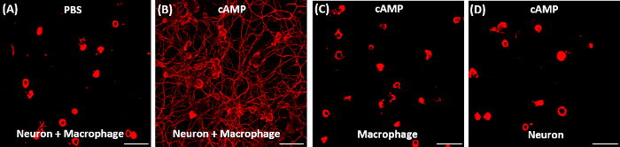 Neuronal macrophage interaction experiment; fluorescence microscopy images comparing PBS, cAMP effects.
