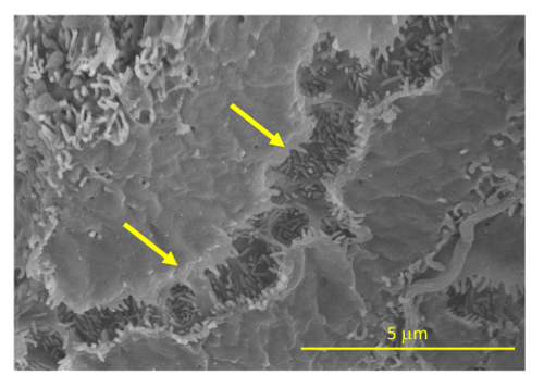 figure-results-10 Scanning electron microscope image; bacterial biofilm structure; magnification with scale bar 5 μm.