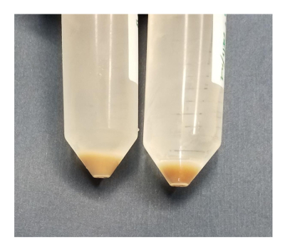figure-results-11 Centrifugation separation process with sediment in conical tubes; experiment result analysis.
