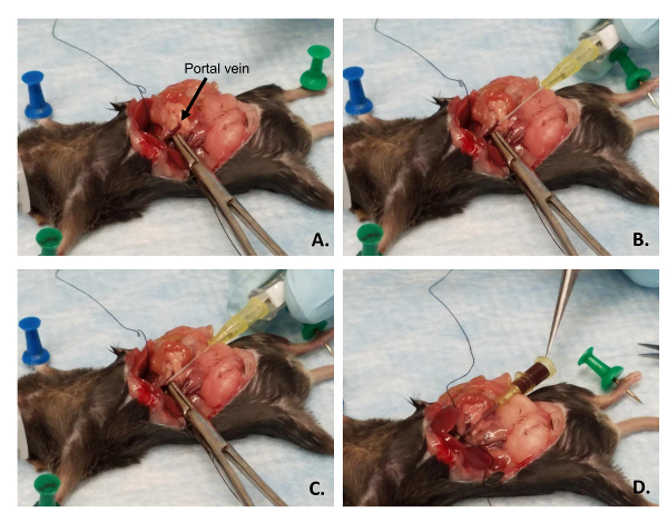 figure-results-4 Surgical procedure on portal vein in rodent model, step-by-step diagram, involving dissection tools.