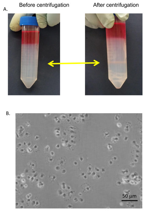 figure-results-9 Centrifugation process diagram with centrifuge tubes; cell suspension microscopy image showing cell density.