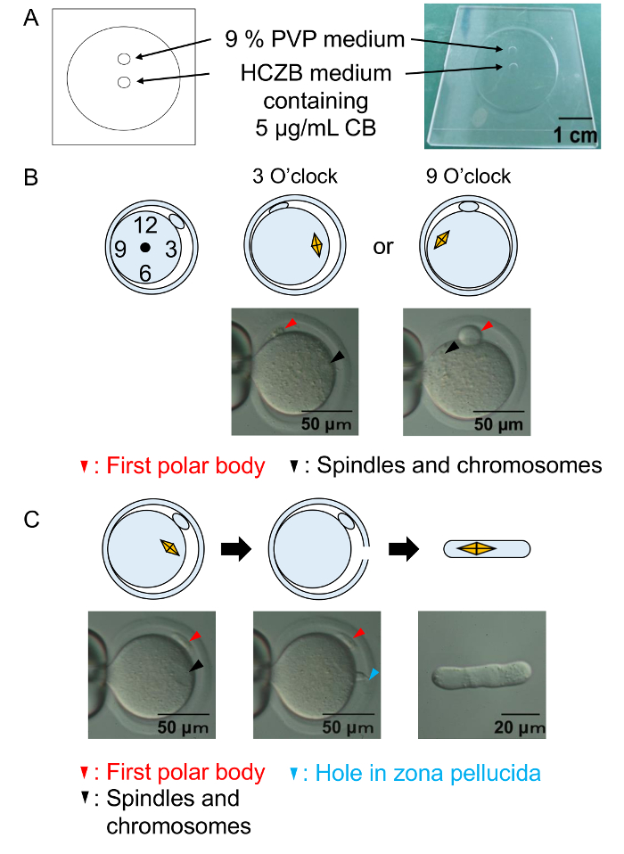 Oocyte microinjection process diagram; polar body, spindle, chromosomes; microscopy analysis.