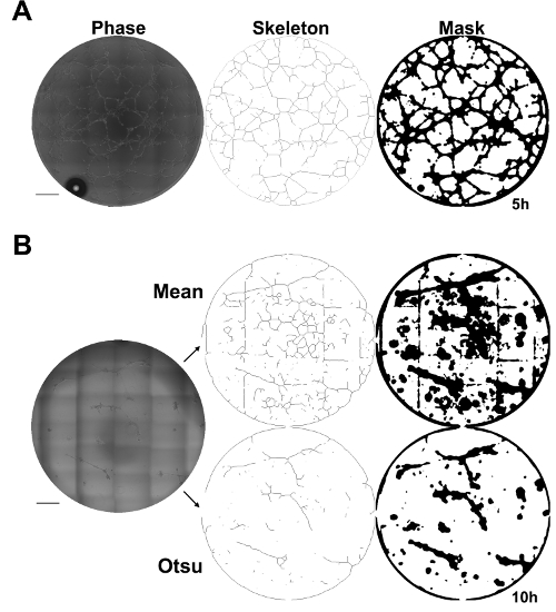 figure-results-2 Phase contrast and segmentation analysis; image processing result showing mask and skeleton diagrams.
