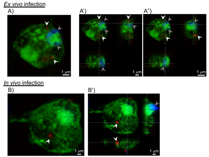 figure-results-4 Ex vivo vs. in vivo infection microscopy, cellular distribution analysis, fluorescence markers used.