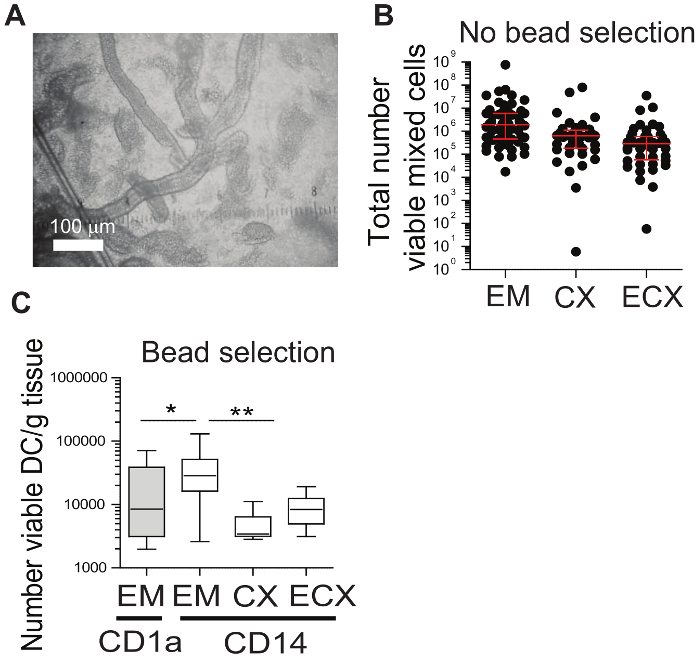 Electron microscopy image, viability scatter plot, and bead selection box plot for cell density analysis.