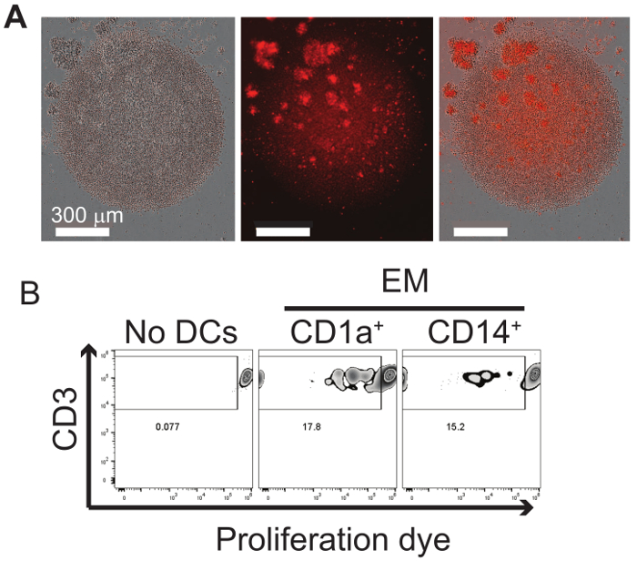 Cell proliferation analysis; microscopy and flow cytometry, CD3 vs proliferation dye, CD1a+, CD14+.