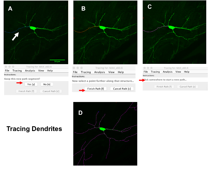 Quantitative Analysis of Neuronal Dendritic Arborization Complexity in ...