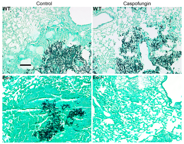 Histological analysis of lung tissue; control vs. Caspofungin; WT and Eo-/-; fungal infection study.