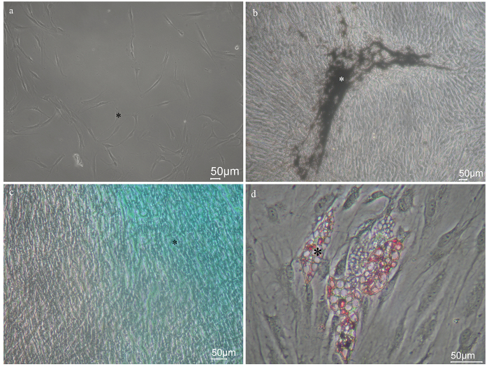Isolation of Mesenchymal Stem Cells from Human Alveolar Periosteum and ...