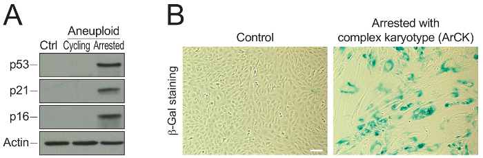 figure-results-1 Aneuploid cell study, western blot of proteins p53, p21, p16, β-Gal staining, cell cycle arrest.