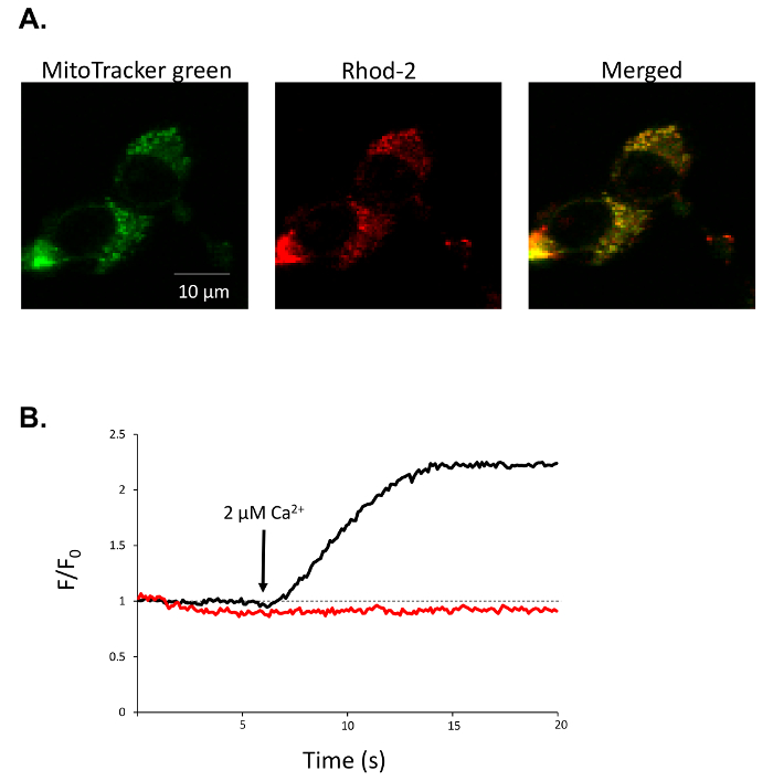 Analyses of Mitochondrial Calcium Influx in Isolated Mitochondria and ...