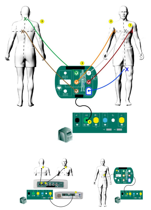 figure-results-2 Electrocardiography (ECG) diagram; electrode placement, signal leads, heart rhythm measurement.