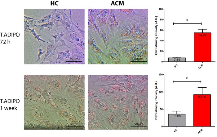 Microscope images and bar graphs of T.ADIPO cell staining intensity after 72h and 1 week.