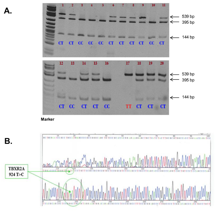 Electrophoresis result and DNA sequencing, PCR analysis, band patterns, genetic variation detection.