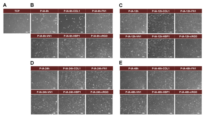 Cell adhesion analysis, various substrates, microscopy image, time-lapse, substrate interaction.