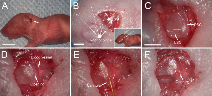 Mouse embryo ear surgery diagram; root of pinna, LSC, PSC, cannula placement, anatomical study.