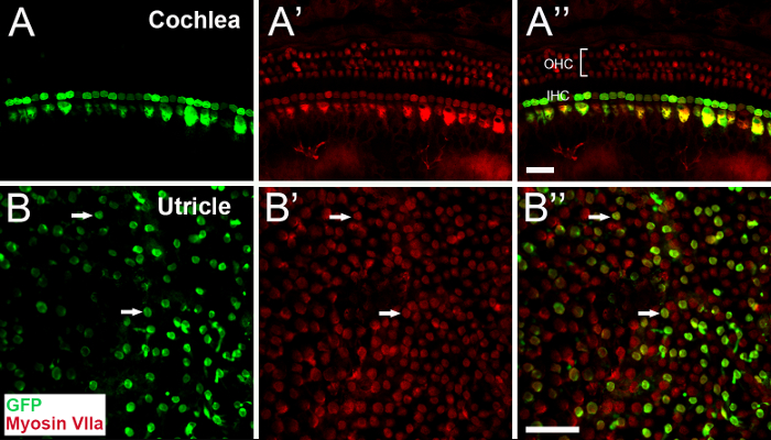 Fluorescence labeling of cochlea and utricle cells; GFP and Myosin VIIa in microscopy images.