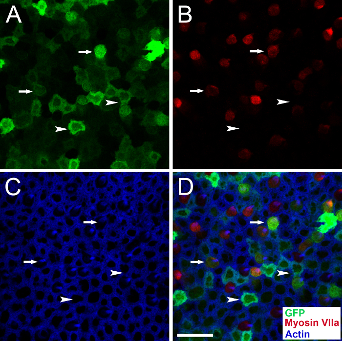 Fluorescence microscopy of cells; GFP, Myosin VIIa, Actin staining; experiment results.