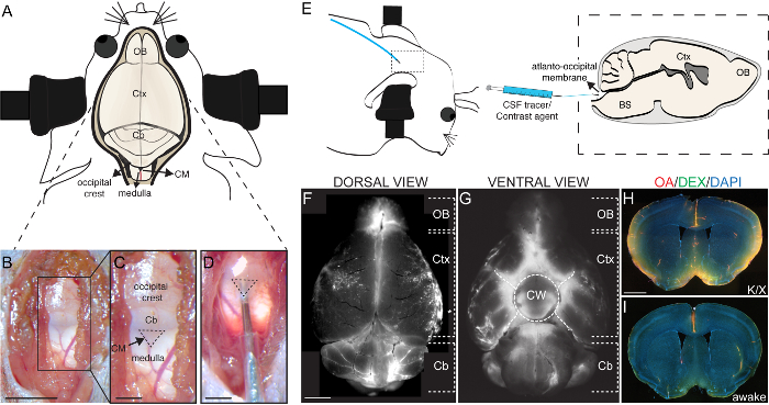 Static equilibrium diagram and microscopy images; brain structure analysis; CSF tracer path illustration.