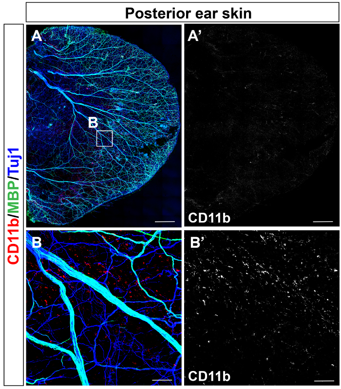 Ear Microscopy View Whole-mount Confocal Microscopy for Adult Ear Skin: A Model System to ...
