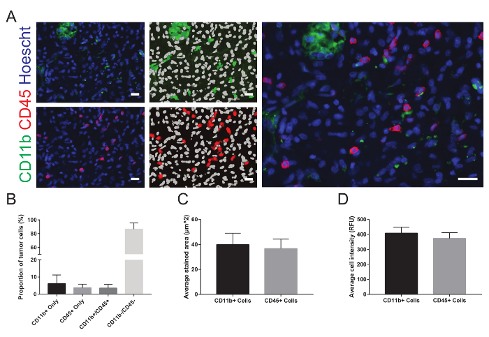 figure-results-10 Immunofluorescence microscopy showing CD11b, CD45 cell staining; bar graphs of tumor cell analysis results.