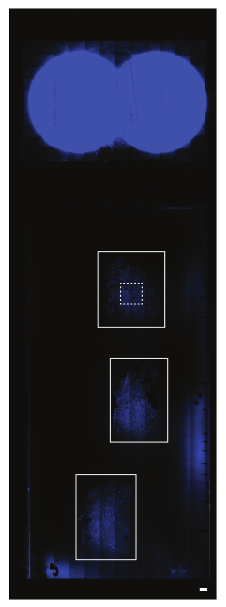 figure-results-6 TLC chromatography UV image; protein separation diagram for purification analysis.
