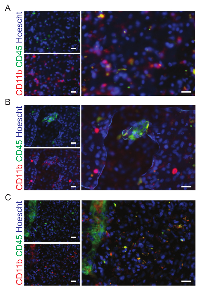 figure-results-9 Fluorescence microscopy image; CD11b, CD45, Hoescht staining; cell identification; immunofluorescence.